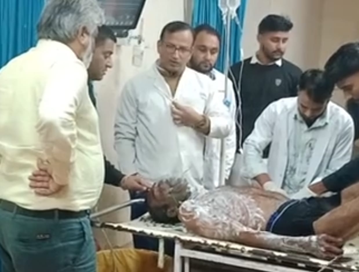 Churu मे पत्नि से परेशान हुआ पति, खुद को लगाई आग, अस्पताल मे भर्ती
